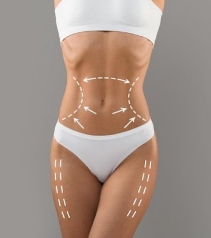 Bodyforming / Bodysculpting (EMS)